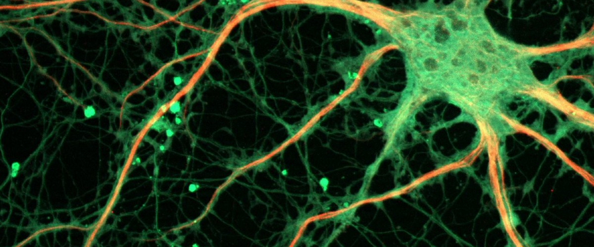 Ученые обнаружили, что ЛСД улучшает нейрогенез, память и нейропластичность у здоровых людей