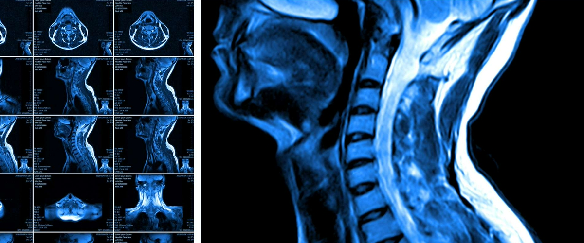 Спинальная травма в свете диагностических изображений