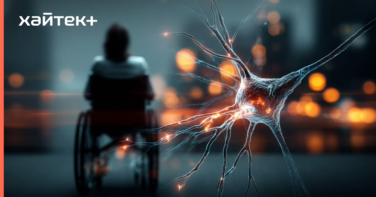 У рассеянного склероза нашли два различных биологических пути развития