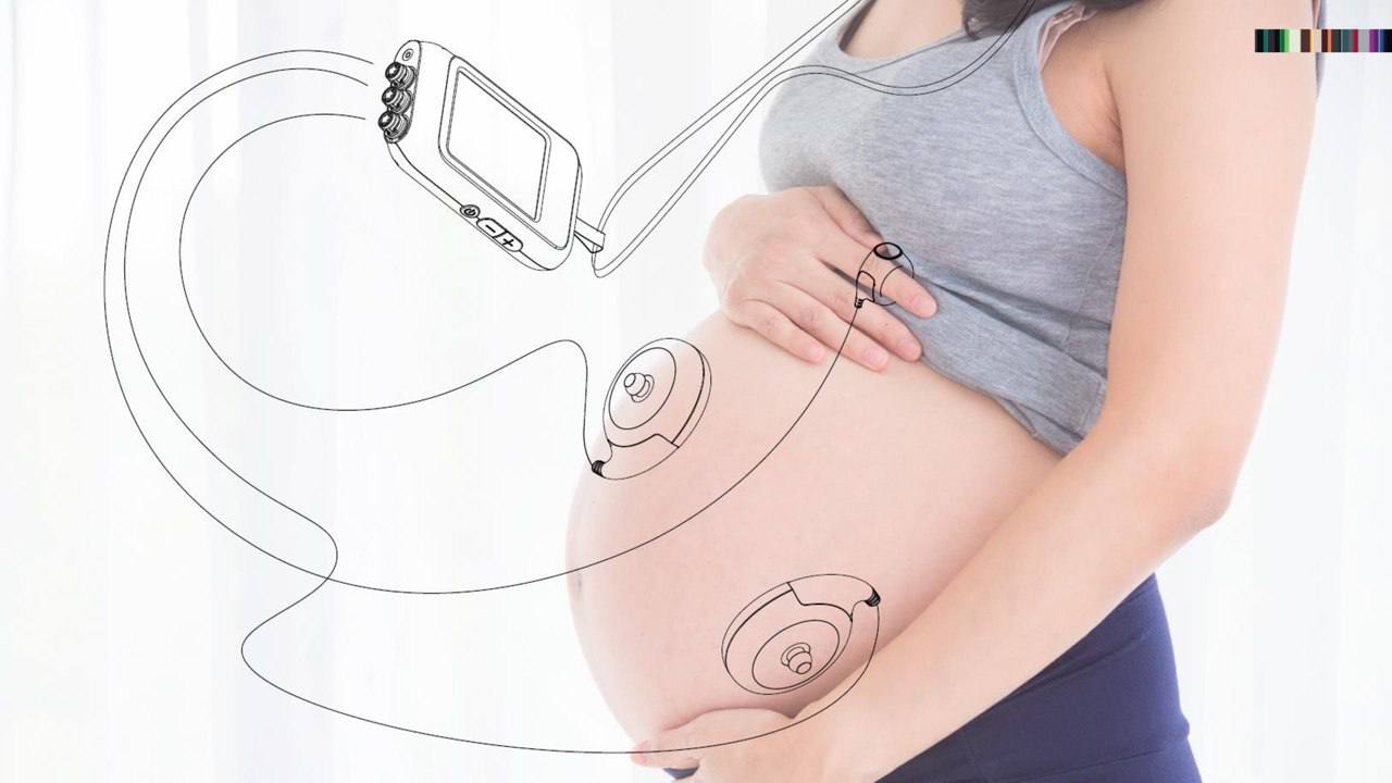 Что делать если остановился желудок. Дистанционный мониторинг беременности.