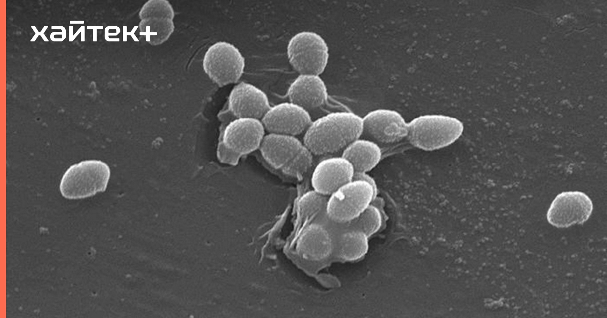 Enterococcus l3