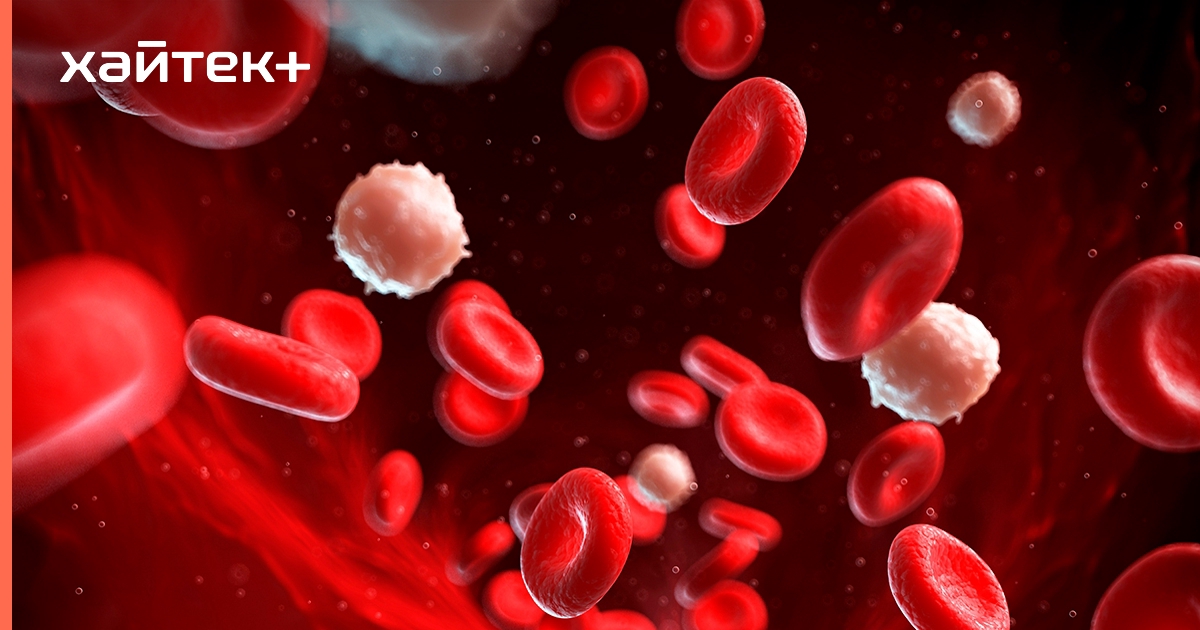 Онкозаболевания крови. Клетки крови. Раковые клетки в крови под микроскопом. Кровь при лейкемии под микроскопом. Белокровие под микроскопом.