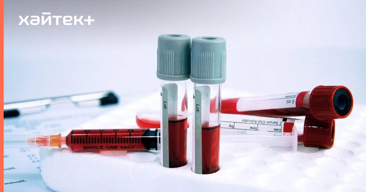 Ученые разработали экспресс-тест на ВИЧ