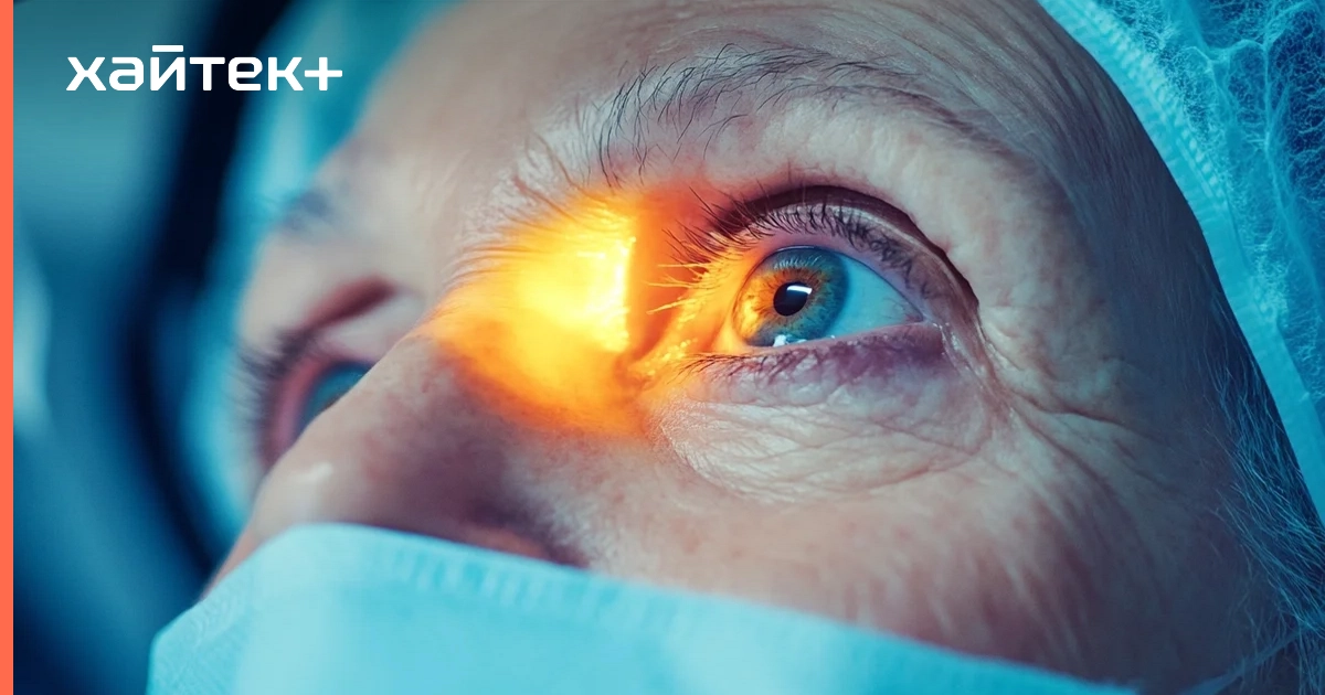 Робот впервые провел операцию по удалению катаракты