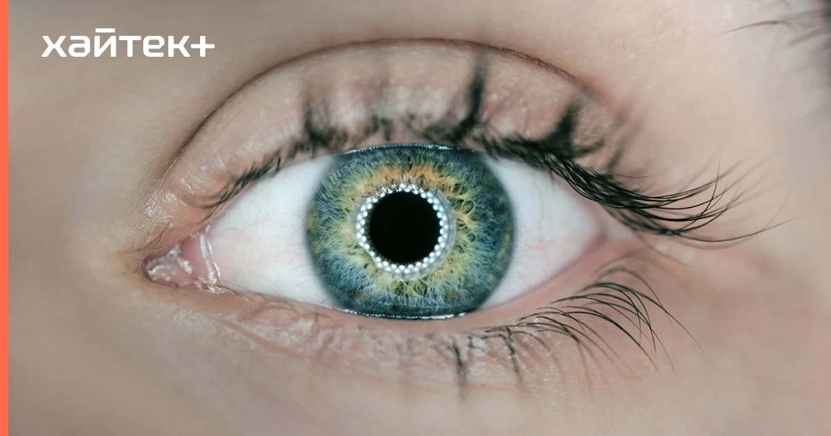 Напечатанная на принтере роговица вернула зрение слепому пациенту