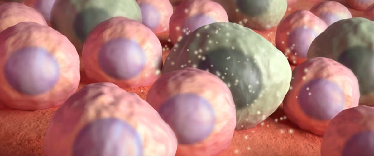 Ученые нашли причину накопления зомби-клеток, вызывающих рак и деменцию