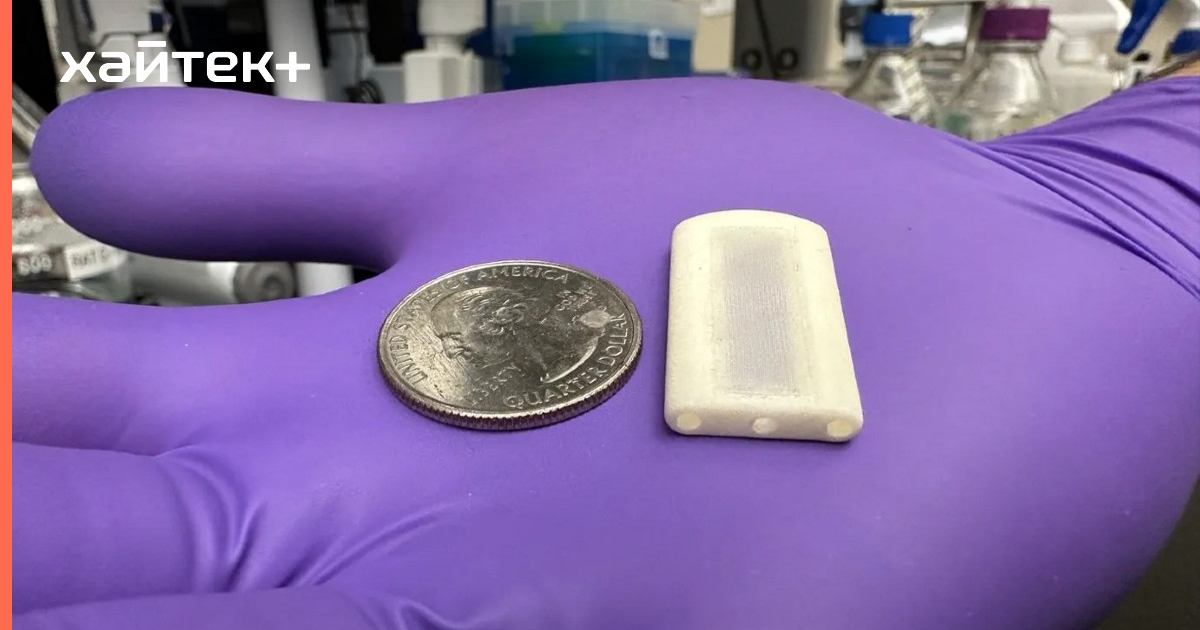 Новый имплант может изменить принцип лечения диабета первого типа