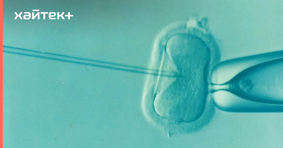 микрохирургия цитология. методы цитологии 1) микроскопия. микроманипуляторы в гистологии. методы изучения клетки таблица 10 класс. метод культуры клеток.
